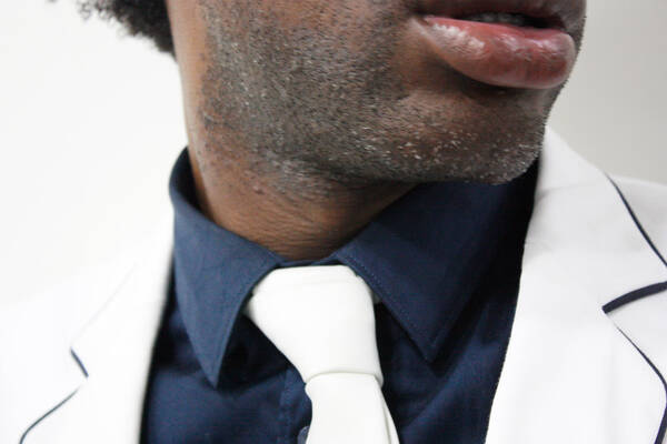 Close-Up der Halsregion eines dunkelhäutigen Mannes mit Dreitagebart. Dunkelblauer Hemdkragen, Weißes Sakko und weiße Kravatte.