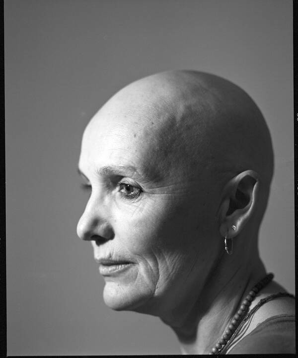 Portrait einer kahlköpfigen Frau im Profil. Schwarz-Weiß