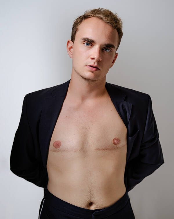 Portrait eines jungen Mannes, die Arme sind hinter dem Körper so dass das Jackett den nackten Oberkörper freigibt: Unter den Brustwarzen sind auf beiden Seiten große Narben zu sehen.